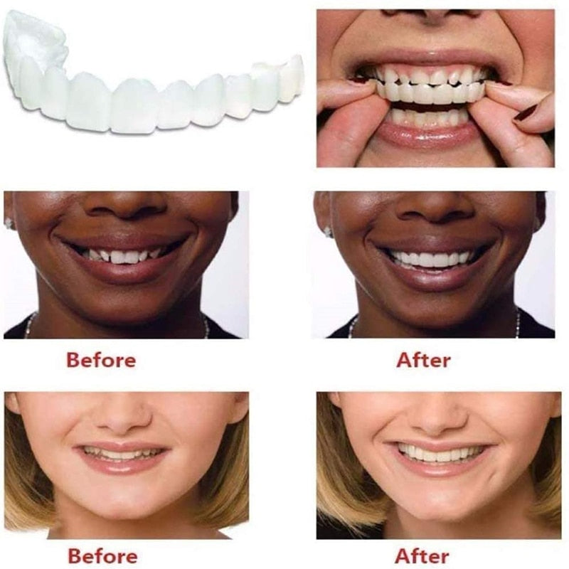 Silicone Teeth Whitening Teeth Cover